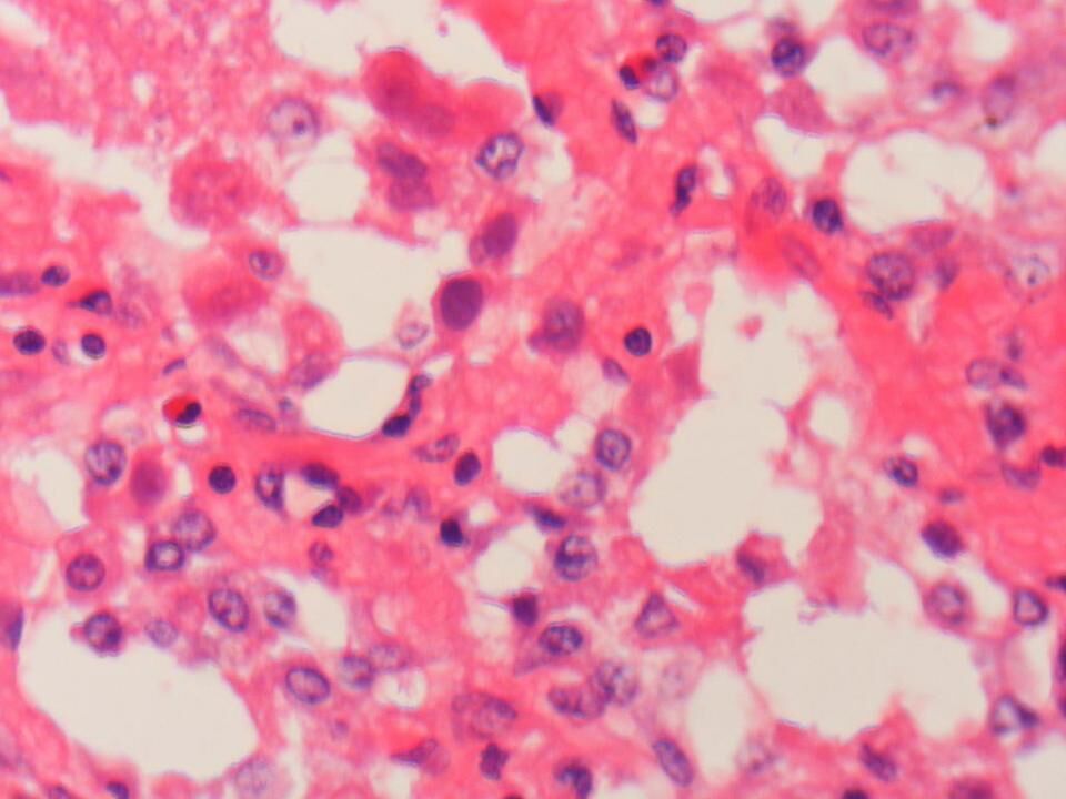 Adenovirus